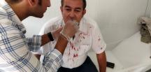 ÇGC’den A Haber muhabiri Halil İbrahim Uğur’a yapılan saldırı girişimine tepki…